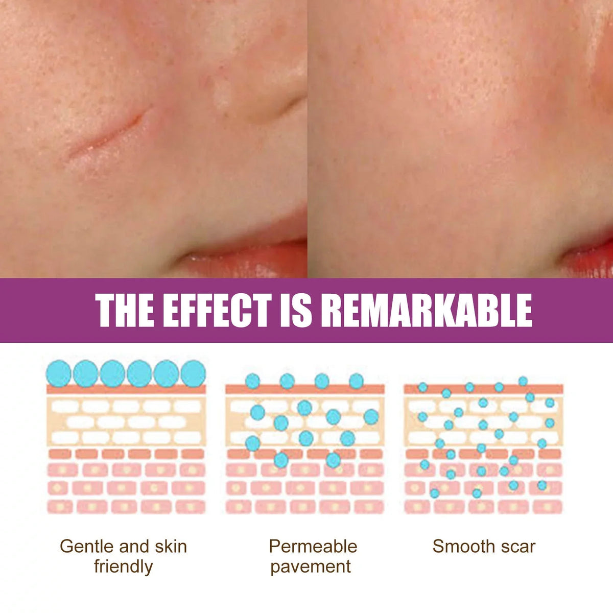 2PCS Scar Removal Cream Scar Repair Cream Scar Removal and Skin Repair 50ml